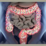 Medical illustration showing inflamed intestines and colon highlighted in red, demonstrating gastrointestinal inflammation typical in FPIES reactions.